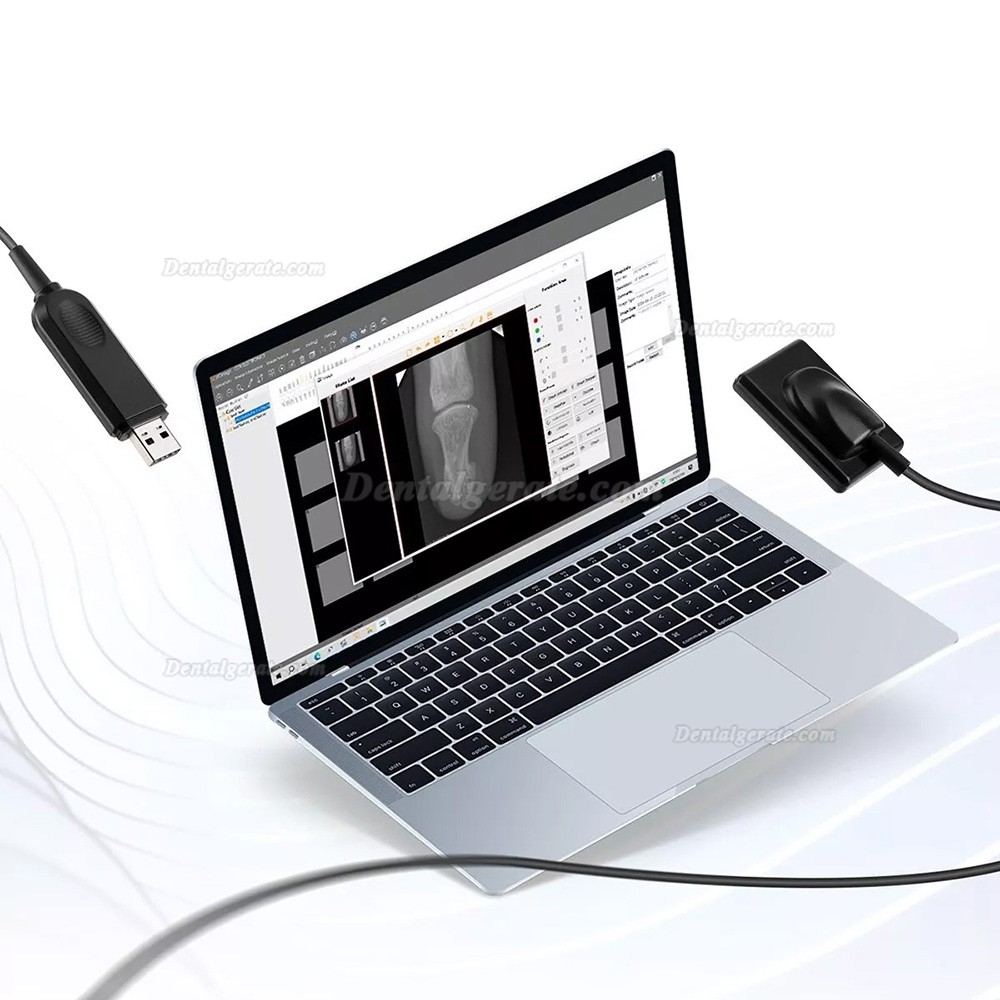 Handheld IntraoralR&ouml;ntgenger&auml;t Zahnarzt Mobiles R&ouml;ntgenger&auml;t + 2230 / 2635 Digitaler R&ouml;ntgensensor
